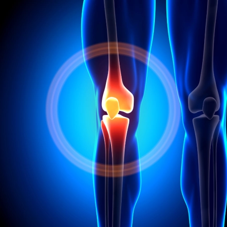 Imagen moderna referente al dolor de rodilla