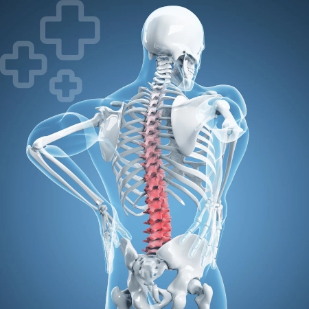 Dolor lumbar
